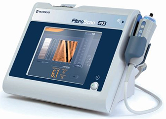 Fibroscan