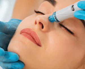 HYDRAFACIAL