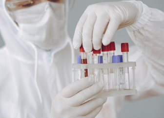 Haploidentical BMT Services including T-cell Depleted and Immunotherapy Services