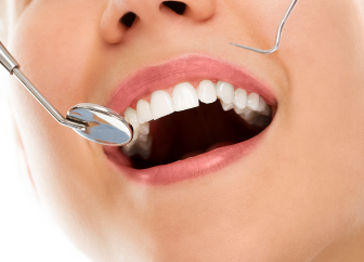 Pits and Fissure Sealants