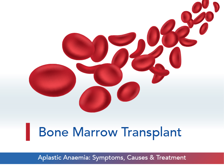 Aplastic Anaemia: Symptoms, Causes & Treatment