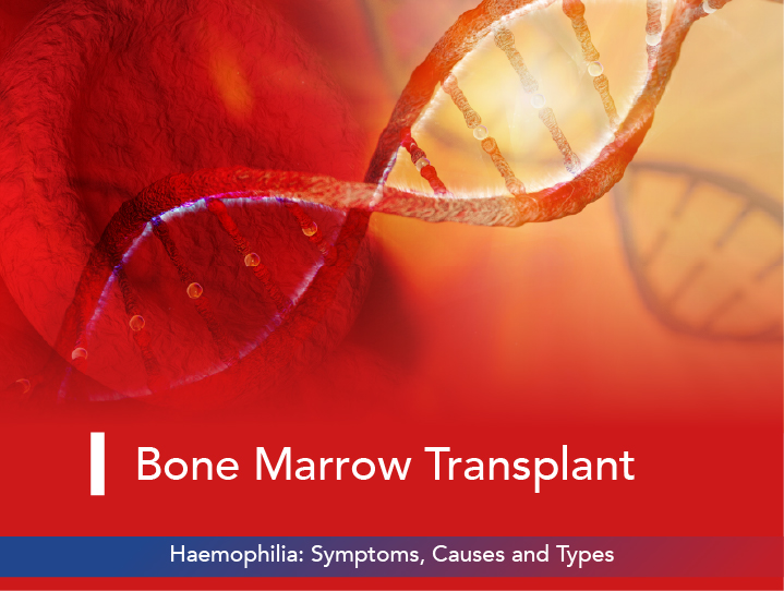 Haemophilia: Symptoms, Causes, and Types