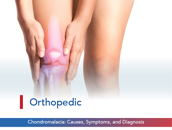 Chondromalacia: Causes, Symptoms, and Diagnosis