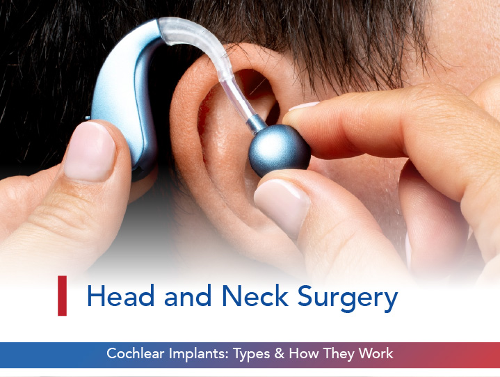 Cochlear Implants: Types & How They Work