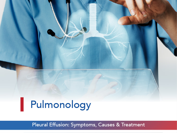 Pleural Effusion: Symptoms, Causes & Treatment