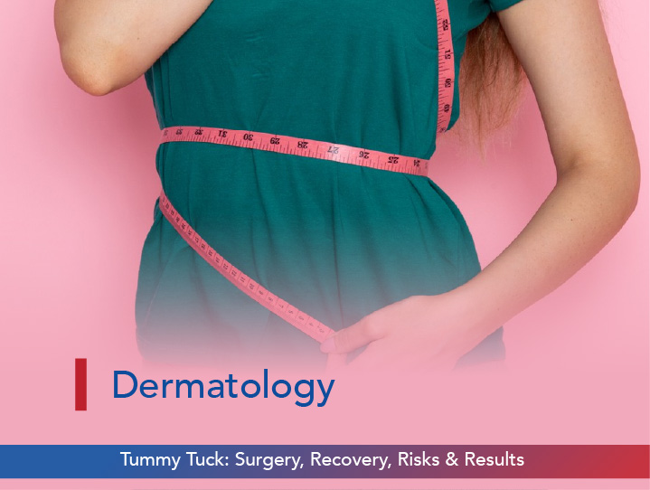 Tummy Tuck: Surgery, Recovery, Risks & Results