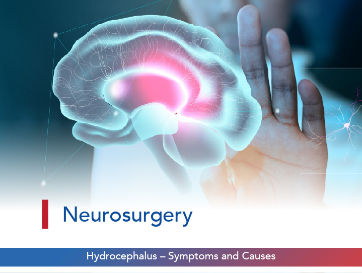 Hydrocephalus – Symptoms and Causes