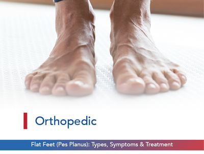 Flat Feet (Pes Planus): Types, Symptoms & Treatment