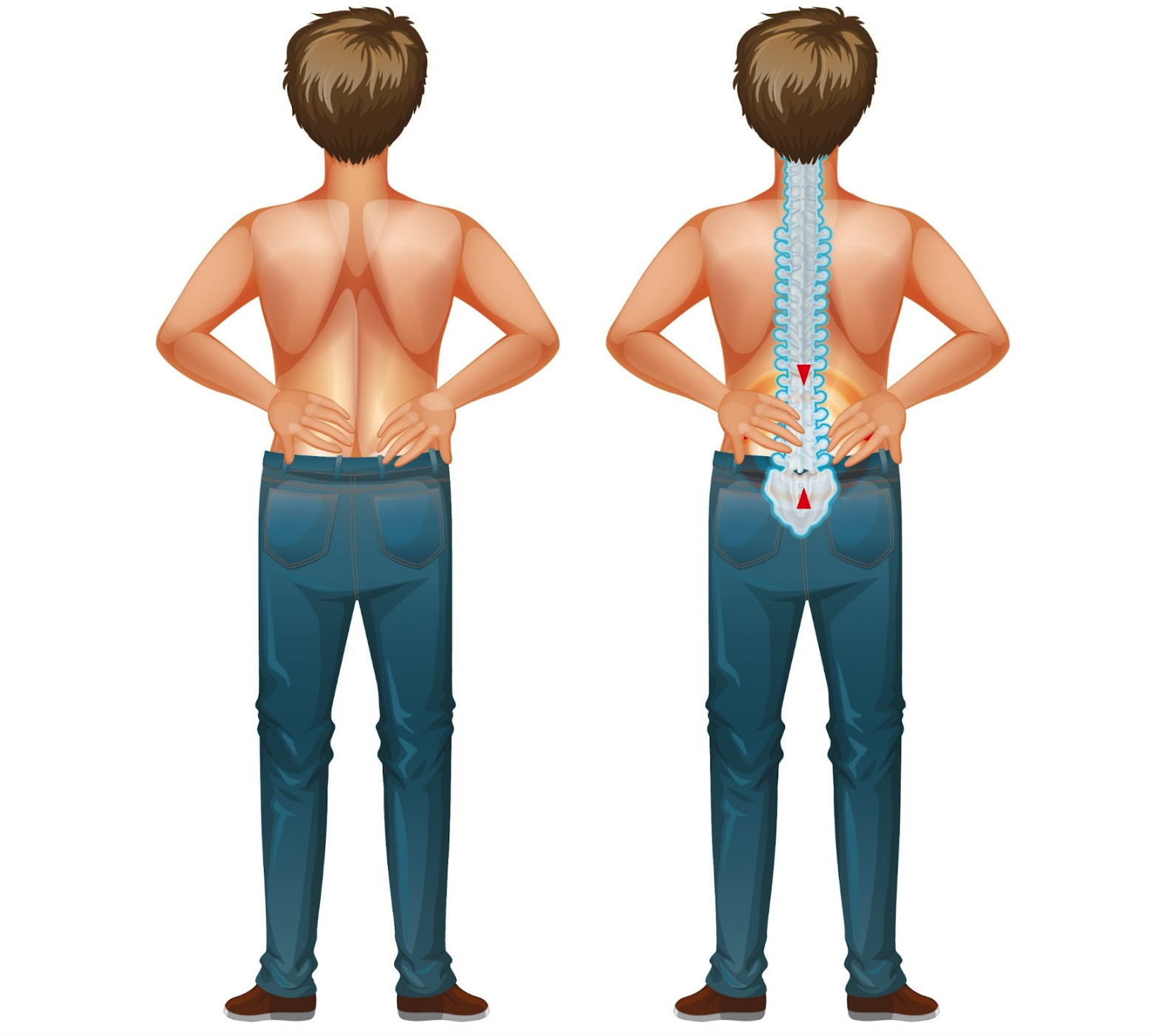 Scoliosis Imaeg