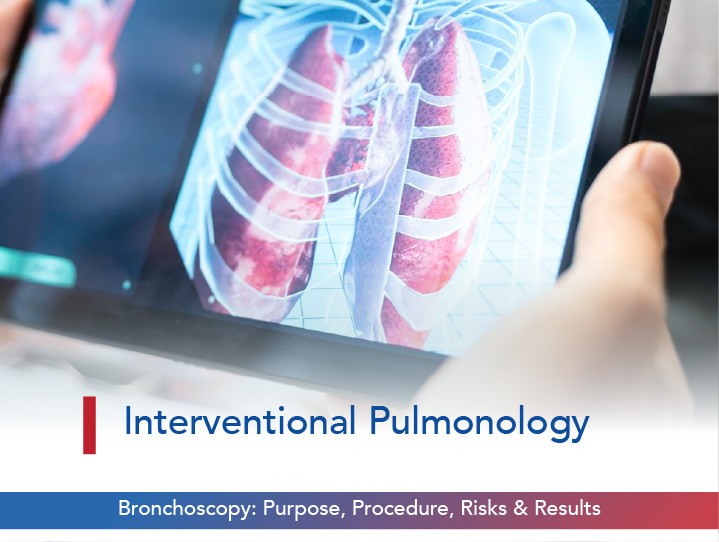Bronchoscopy: Purpose, Procedure, Risks & Results