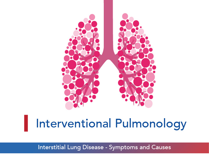 Interstitial Lung Disease – Symptoms and Causes