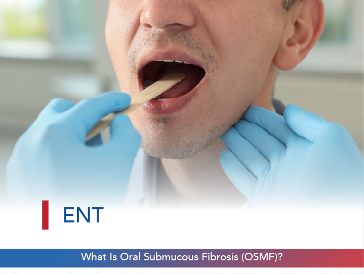 What Is Oral Submucous Fibrosis (OSMF)?