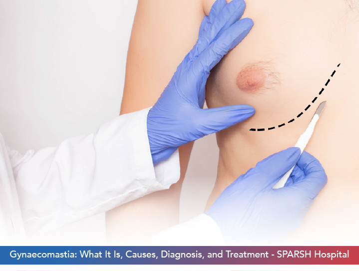 Gynaecomastia: What It Is, Causes, Diagnosis, and Treatment