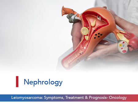 Leiomyosarcoma: Symptoms, Treatment & Prognosis