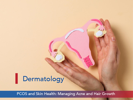 PCOS and Skin Health: Managing Acne and Hair Growth