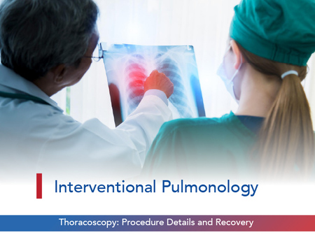 Thoracoscopy: Procedure Details and Recovery