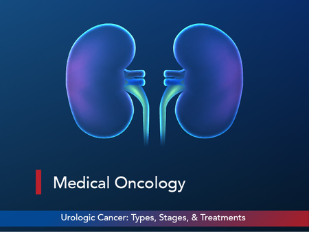 Urologic Cancer: Types, Stages, & Treatments
