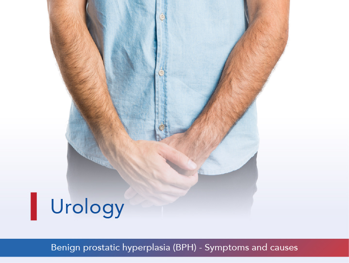 Benign Prostatic Hyperplasia (BPH) - Symptoms and Causes