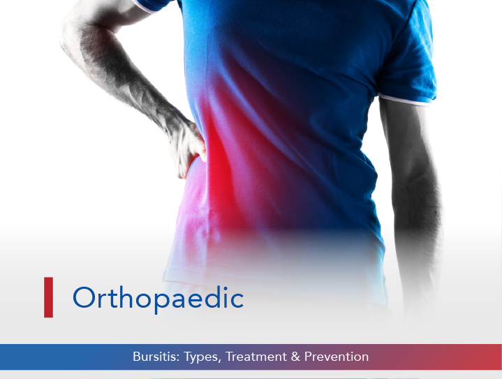Bursitis: Types, Treatment, and Prevention